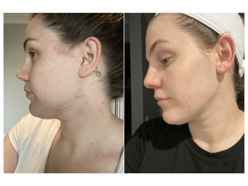 Breakout Bundle Before and After Results